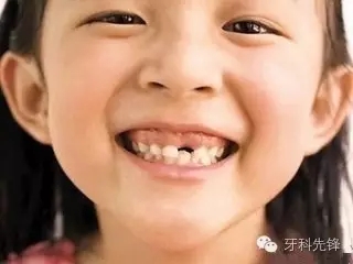 拔牙斷根了怎么辦？