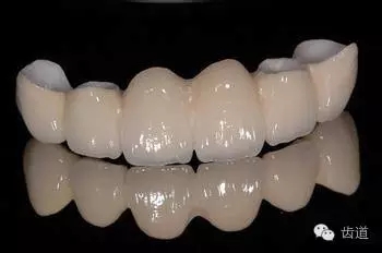 為何烤瓷牙的價格從幾百元至數(shù)千元不等？告訴您11種烤瓷牙的特點、價格及優(yōu)缺點