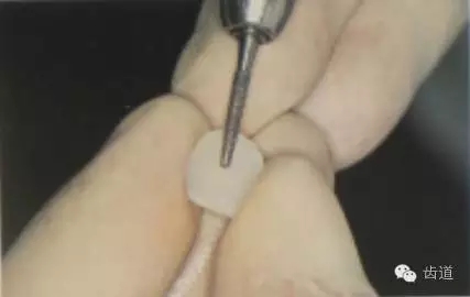 瓷貼面的粘接步驟及技術要點