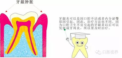 【愛牙科普知識(shí)300問】 “什么是牙本質(zhì)敏感？”
