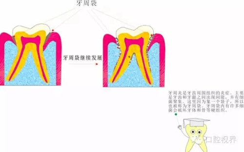【愛牙科普知識(shí)300問】 “什么是牙本質(zhì)敏感？”