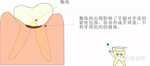 【愛牙科普知識(shí)300問】 “什么是融合牙、愈合牙和雙生牙？”