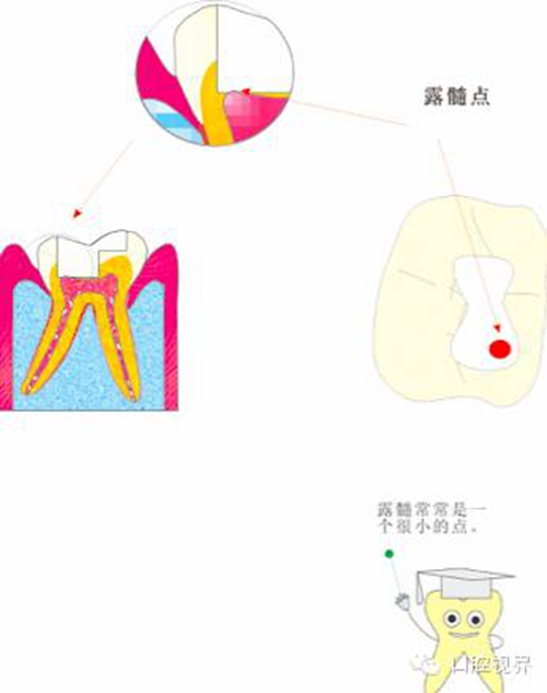 【愛牙科普知識(shí)300問】 “什么是融合牙、愈合牙和雙生牙？”
