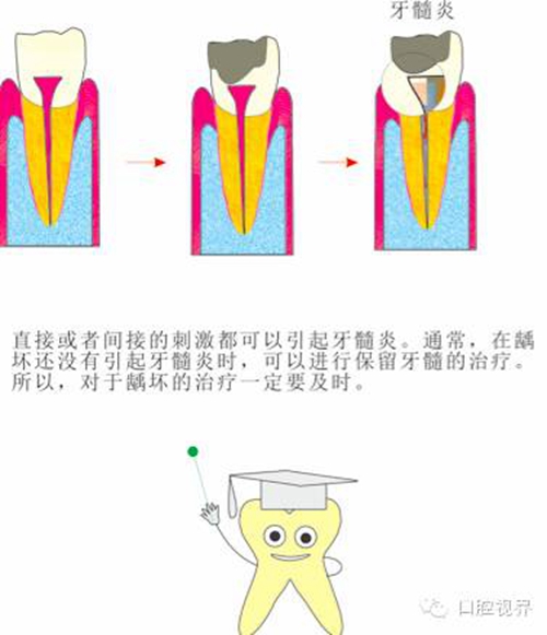 【愛牙科普知識(shí)300問】 “什么是融合牙、愈合牙和雙生牙？”