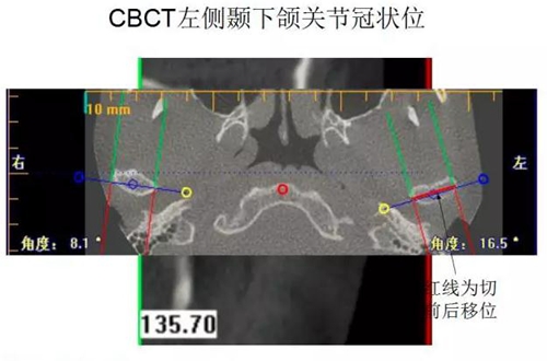 	口腔修復(fù)治療中，常見(jiàn)臨床接診流程