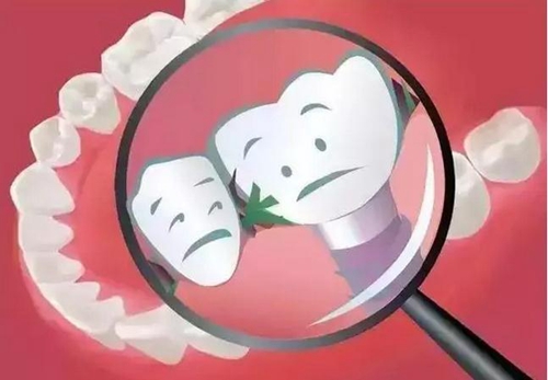 為什么吃東西老塞牙？小心這些??！  