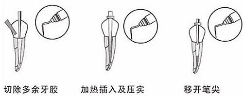 新熱熔充填系統C-Fill