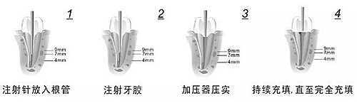 新熱熔充填系統C-Fill