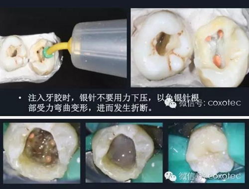 新熱熔充填系統C-Fill