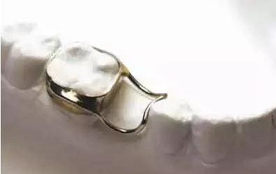 間隙保持器的應用