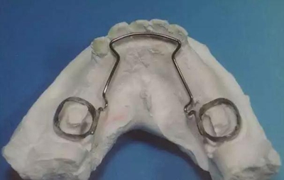 間隙保持器的應用