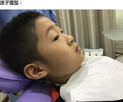 多生牙的拔除總原則：早發現，早處理！