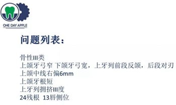 多學科病例分析---正畸、種植、微創(chuàng)拔牙多學科交叉病例