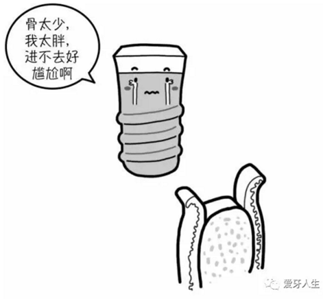 如何選擇種植牙，給《患者》推薦這篇文章就足矣