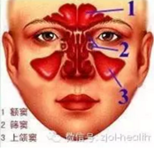 拔牙后引出“偏頭痛”！這種情況絕不能置之不理！