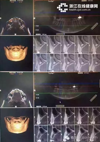 杭州口腔醫院城西分院