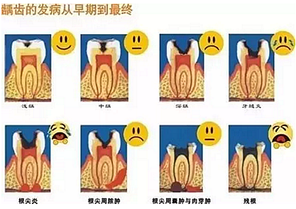 為什么有些牙齒，醫生不給我補？
