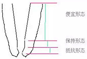 知識(shí)分享：根管治療的標(biāo)準(zhǔn)步驟
