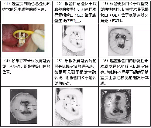 知識(shí)分享：根管治療的標(biāo)準(zhǔn)步驟