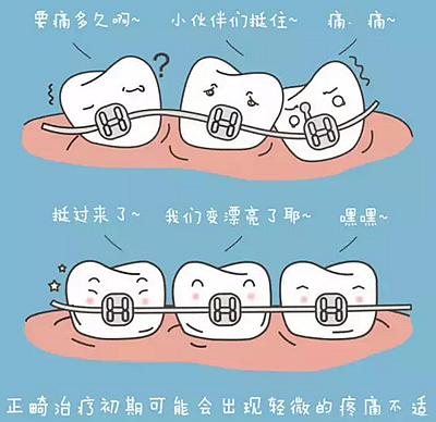 牙齒正畸過程中需注意哪些事項？