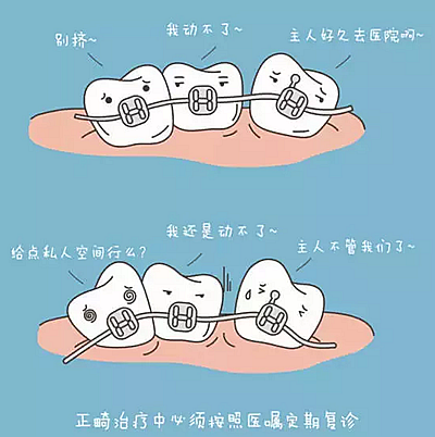 牙齒正畸過程中需注意哪些事項？