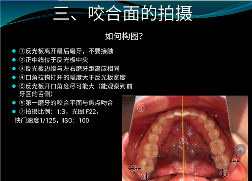 口內照攝影方法與技巧分享