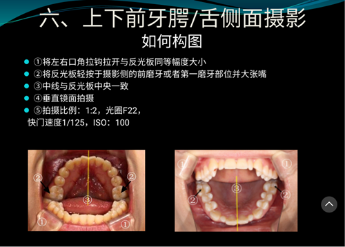口內照攝影方法與技巧分享