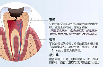 多頻技術的根管長度測定儀