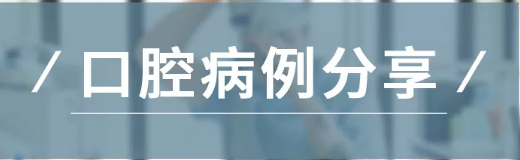 病例分享｜復(fù)合樹(shù)脂微創(chuàng)美學(xué)修復(fù)關(guān)閉上前牙間隙