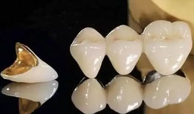 補牙不做冠，療效少一半！根管治療后牙齒已經(jīng)不疼了，為什么還要戴牙冠呢？