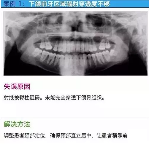 曲斷的10大經(jīng)典失誤案例及原因分析！