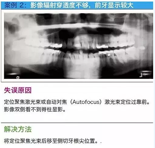 曲斷的10大經(jīng)典失誤案例及原因分析！