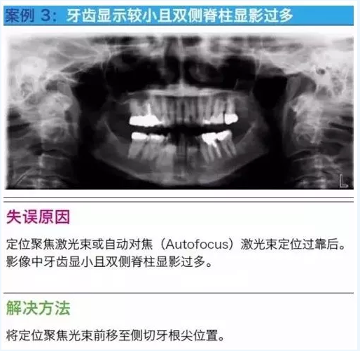 曲斷的10大經(jīng)典失誤案例及原因分析！