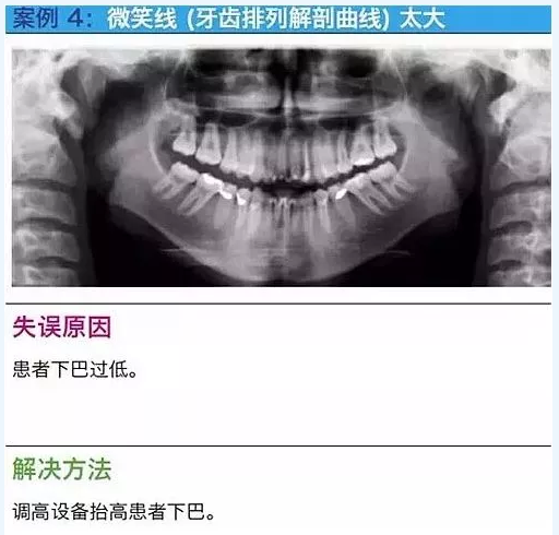 曲斷的10大經(jīng)典失誤案例及原因分析！
