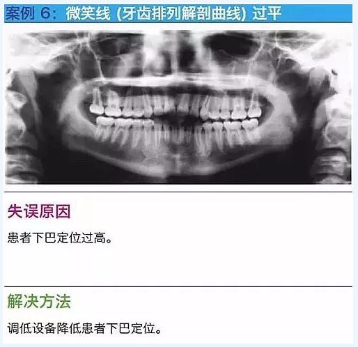 曲斷的10大經(jīng)典失誤案例及原因分析！