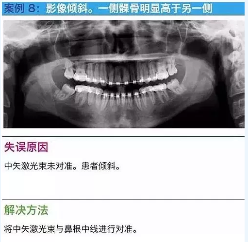 曲斷的10大經(jīng)典失誤案例及原因分析！
