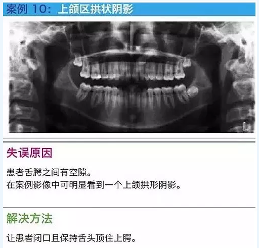 曲斷的10大經(jīng)典失誤案例及原因分析！