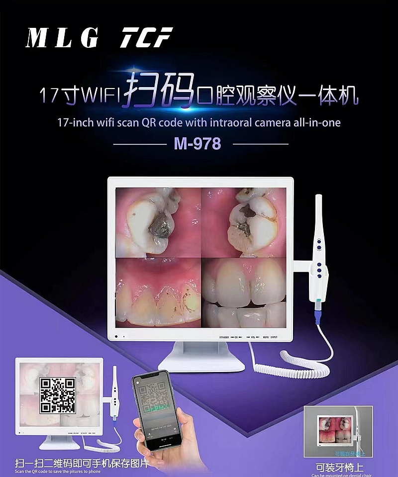 美力光內窺鏡
